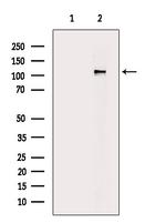 Phospho-Rb (Thr252) Antibody in Western Blot (WB)