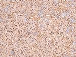 Phospho-BRCA1 (Ser1497) Antibody in Immunohistochemistry (Paraffin) (IHC (P))