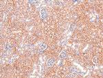 Phospho-delta Catenin (Tyr257) Antibody in Immunohistochemistry (Paraffin) (IHC (P))