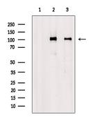 Phospho-delta Catenin (Tyr257) Antibody in Western Blot (WB)