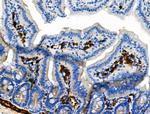 Phospho-delta Catenin (Tyr904) Antibody in Immunohistochemistry (Paraffin) (IHC (P))