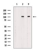 Phospho-delta Catenin (Tyr904) Antibody in Western Blot (WB)