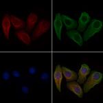 Phospho-Cyclin B1 (Ser133) Antibody in Immunocytochemistry (ICC/IF)