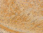 Phospho-RGS19 (Ser151) Antibody in Immunohistochemistry (Paraffin) (IHC (P))