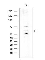 Phospho-HTRA2 (Ser212) Antibody in Western Blot (WB)