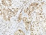 Phospho-MUC1 (Ser1227) Antibody in Immunohistochemistry (Paraffin) (IHC (P))