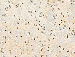 Phospho-PDX1 (Ser66) Antibody in Immunohistochemistry (Paraffin) (IHC (P))