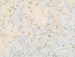 Phospho-PDX1 (Ser66) Antibody in Immunohistochemistry (Paraffin) (IHC (P))