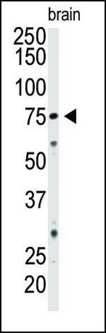 CD73 Antibody in Western Blot (WB)