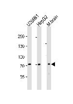 CD73 Antibody in Western Blot (WB)