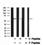 Phospho-Presenilin 1 (Ser353) Antibody in Western Blot (WB)