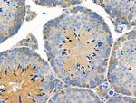 Phospho-SGOL1 (Ser14) Antibody in Immunohistochemistry (Paraffin) (IHC (P))