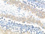 Phospho-SGOL1 (Ser14) Antibody in Immunohistochemistry (Paraffin) (IHC (P))