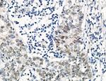 Phospho-SRF (Thr159) Antibody in Immunohistochemistry (Paraffin) (IHC (P))