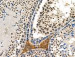 Phospho-SRF (Thr159) Antibody in Immunohistochemistry (Paraffin) (IHC (P))