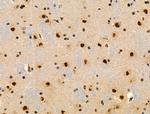 Phospho-SRF (Thr159) Antibody in Immunohistochemistry (Paraffin) (IHC (P))