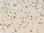 Phospho-TAB1 (Ser438) Antibody in Immunohistochemistry (Paraffin) (IHC (P))