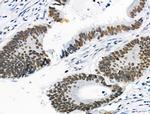 Phospho-Cyclin E (Ser399) Antibody in Immunohistochemistry (Paraffin) (IHC (P))