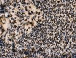 Phospho-Cyclin E (Ser399) Antibody in Immunohistochemistry (Paraffin) (IHC (P))