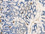 Phospho-DOK2 (Tyr345) Antibody in Immunohistochemistry (Paraffin) (IHC (P))