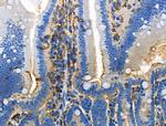 Phospho-DOK2 (Tyr345) Antibody in Immunohistochemistry (Paraffin) (IHC (P))