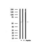 Phospho-DOK2 (Tyr345) Antibody in Western Blot (WB)