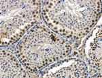 Phospho-ETS1 (Ser251) Antibody in Immunohistochemistry (Paraffin) (IHC (P))