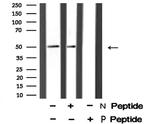 Phospho-ETS1 (Ser251) Antibody in Western Blot (WB)