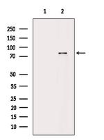 Phospho-PKC alpha (Ser657) Antibody in Western Blot (WB)