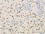 Phospho-p130 (Thr642) Antibody in Immunohistochemistry (Paraffin) (IHC (P))