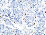 Phospho-RRAS (Tyr66) Antibody in Immunohistochemistry (Paraffin) (IHC (P))