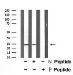 Phospho-RRAS (Tyr66) Antibody in Western Blot (WB)