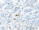 Phospho-S100A9 (Thr113) Antibody in Immunohistochemistry (Paraffin) (IHC (P))