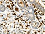 Phospho-S100A9 (Thr113) Antibody in Immunohistochemistry (Paraffin) (IHC (P))