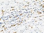 Phospho-S100A9 (Thr113) Antibody in Immunohistochemistry (Paraffin) (IHC (P))