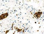 Phospho-S100A9 (Thr113) Antibody in Immunohistochemistry (Paraffin) (IHC (P))