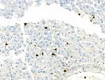 Phospho-S100A9 (Thr113) Antibody in Immunohistochemistry (Paraffin) (IHC (P))