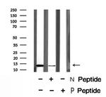 Phospho-S100A9 (Thr113) Antibody in Western Blot (WB)