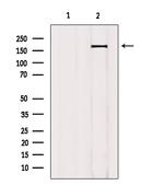 Phospho-TOP2A (Ser1337) Antibody in Western Blot (WB)