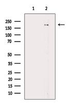 Phospho-TOP2A (Ser1337) Antibody in Western Blot (WB)