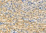 SFRP1 Antibody in Immunohistochemistry (Paraffin) (IHC (P))