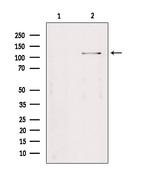 TAOK2 Antibody in Western Blot (WB)