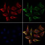 FGR Antibody in Immunocytochemistry (ICC/IF)