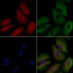 FGR Antibody in Immunocytochemistry (ICC/IF)