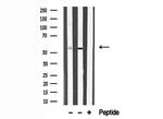 FGR Antibody in Western Blot (WB)