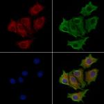 ACVRL1 Antibody in Immunocytochemistry (ICC/IF)