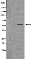 ACVRL1 Antibody in Western Blot (WB)