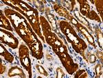 MKL1 Antibody in Immunohistochemistry (Paraffin) (IHC (P))