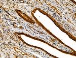 MKL1 Antibody in Immunohistochemistry (Paraffin) (IHC (P))