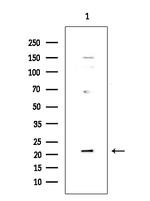 DUSP22 Antibody in Western Blot (WB)